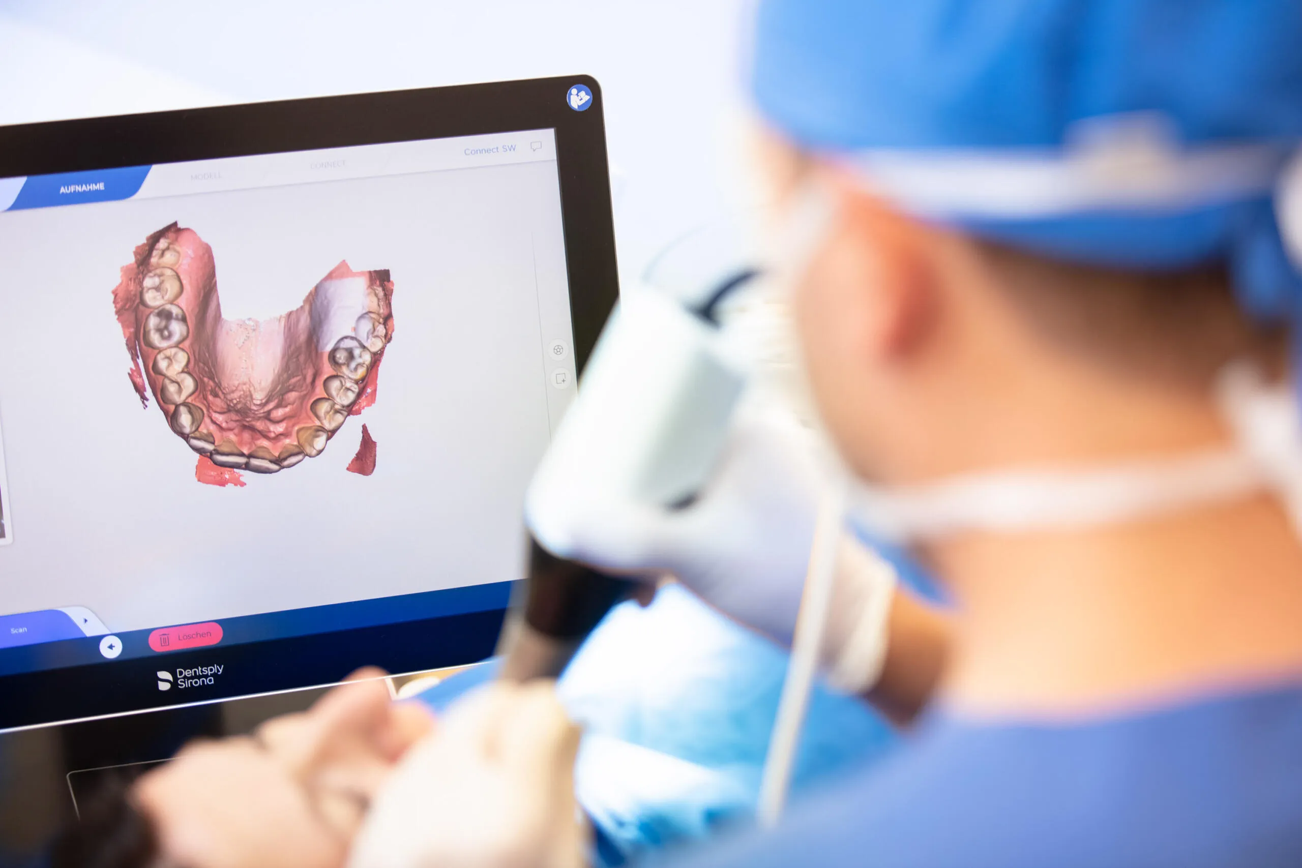 Ein scharfer Computerbildschirm zeigt das farbige 3D-Modell eines Unterkiefers, während im unscharfen Vordergrund ein Zahnarzt einen Intraoralscanner führt.
